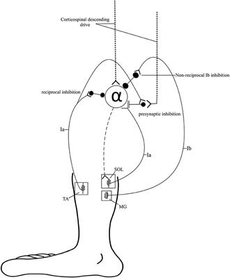 Disrupted Ankle Control and Spasticity in Persons With Spinal Cord Injury: The Association Between Neurophysiologic Measures and Function. A Scoping Review